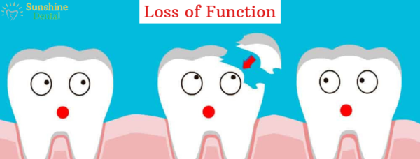 Loss of Function | Best Dental Replacement in Whitefield