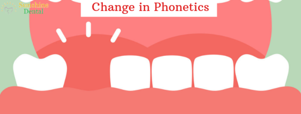Change in Phonetics | Best Dental Replacement in Whitefield