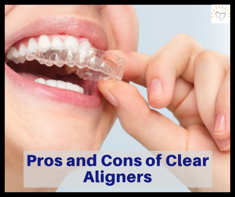 Orthodontic Treatment with Clear Aligners Sunshine Dental