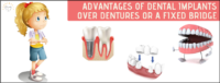 Advantages of Dental Implants Over Dentures Or a Fixed Bridge | Best Dental Implants in Whitefield | Sunshine Dental Advantages of Dental Implants Over Dentures Or a Fixed Bridge | Best Dental Implants in Whitefield | Sunshine Dental