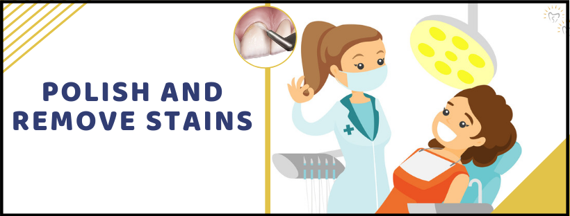 Polish And Remove Stains | Best Dental Care Treatment In Whitefield