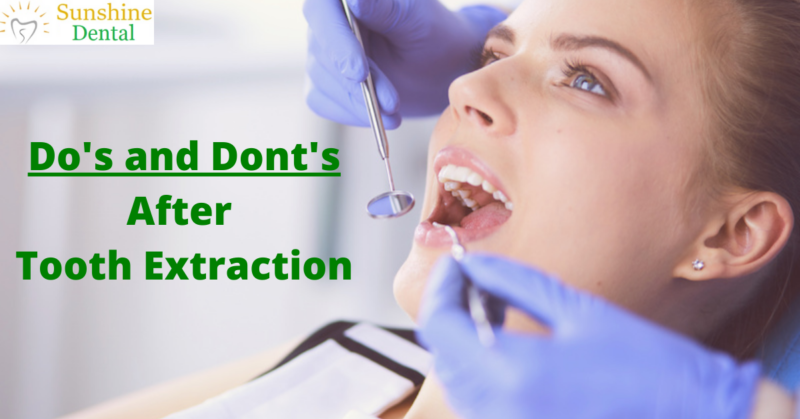 Best Tooth Extraction Clinic In Whitefield Dos And Dont Tooth