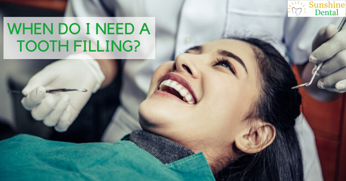 When do I need tooth filling? | Sunshine dental