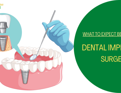 What to Expect Before a Dental Implant Surgery?
